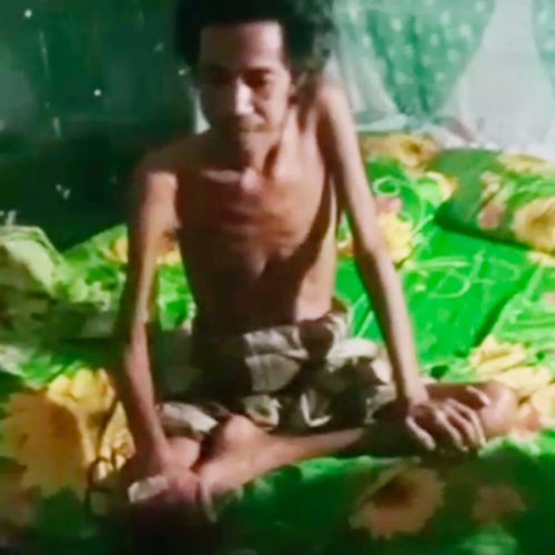 Daeng Nyengka, Warga Moncongkomba yang Menanti Uluran Tangan — Sakit, Lapar, dan Terlupakan